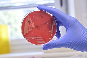 Bild: Bakterienkultur